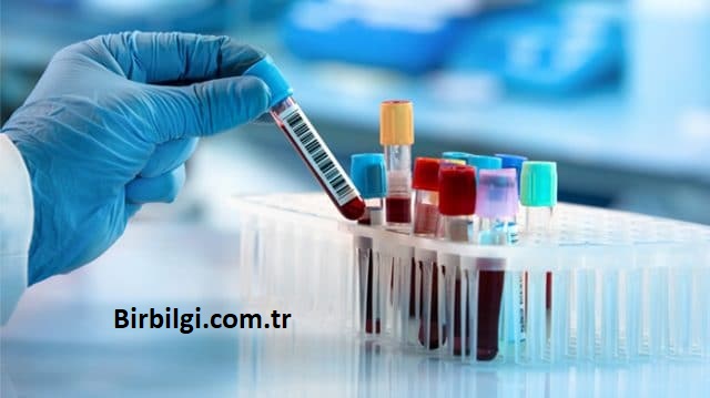 Tıbbi Laboratuvar Teknikleri Maaş 2023 1 Tıbbi Laboratuvar Teknikleri Maaş 2023